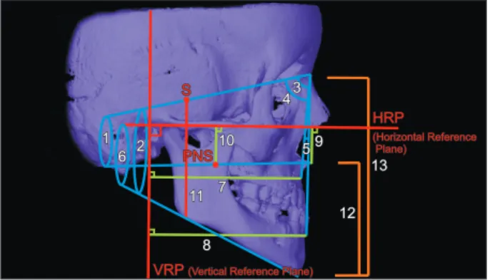 Figure 4. Three-dimensional  reconstruction of the  pharyn-geal airway (PA). 