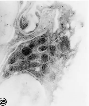 Fig. 9. An e le ctron micros copic photogra ph of type II pne umocyte in the control ra t lungs 