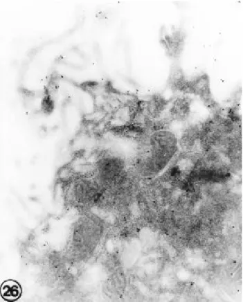 Fig 11. An e le ctron micros copic photogra ph of type II pne umocyte in 7 da y old ra t lung