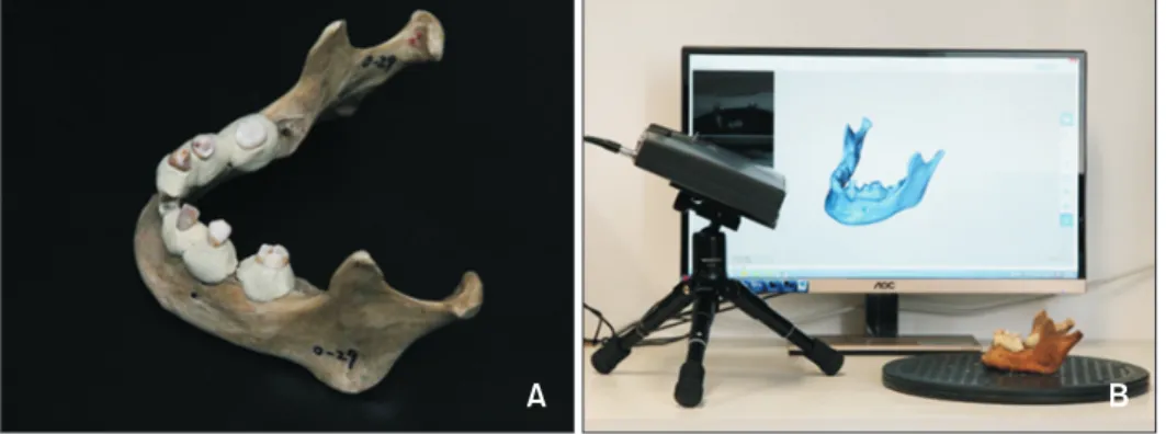 Figure 1. Dry mandible model  acquisition.  A, Six teeth were  inserted into the tooth sockets  of each dry cadaveric  dible to establish a dry  man-dible model