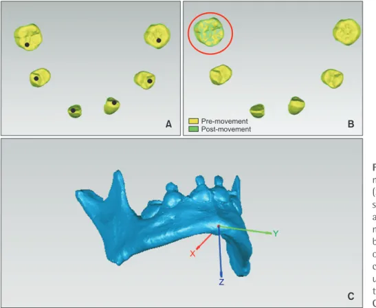 Figure 5. Landmark assign- assign-ment and three-dimensional  (3D) tooth displacement  mea-surements