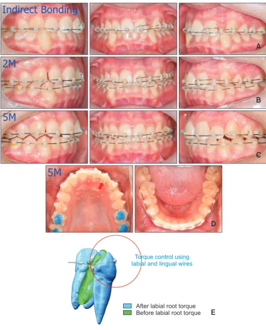 Figure 3. Treatment progress. 