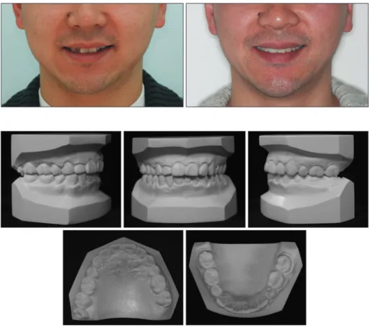 Figure 19. A post-treatment panoramic radiograph.