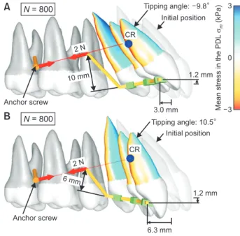 Figure 4A shows the tooth movement pattern in the  combination of the low-positioned screw and  10-mm-high lever arms at N = 800