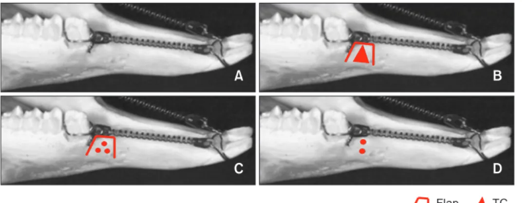 Figure 1. Different study  groups. A, Control group (no  surgical intervention); B,  triangular corticotomy (TC)  group;  C, indentation  corti-cotomy (IC) group; D,  micro-osteoperforation (MP) group.