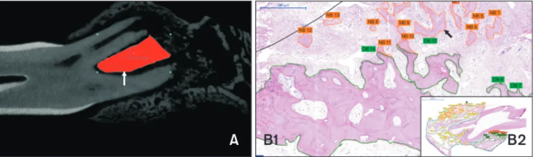 Figure 1. Region of interest (ROI) in quantification of bone microstructure (A) and new bone (NB) and old bone (OB) for- for-mation (B1 and B2)