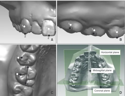 Figure 4. Reference points,  lines, and planes. A, Frontal  view;  B, Sagittal view; C,  Occlusal view; D, Reference  planes