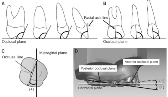 Figure 6. Angular measurements (°). A, Inclination. For the difference between pre- and post-treatment (T0–T1), positive  means labioversion or buccoversion and negative means palatoversion; B, Angulation