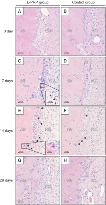 Figure 4. The osteoclast numbers in the leukocyte-plate- leukocyte-plate-let-rich plasma (L-PRP) and control groups