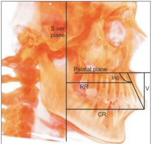 Figure 5. Cone beam computed tomography measure- measure-ments for the upper right central incisor