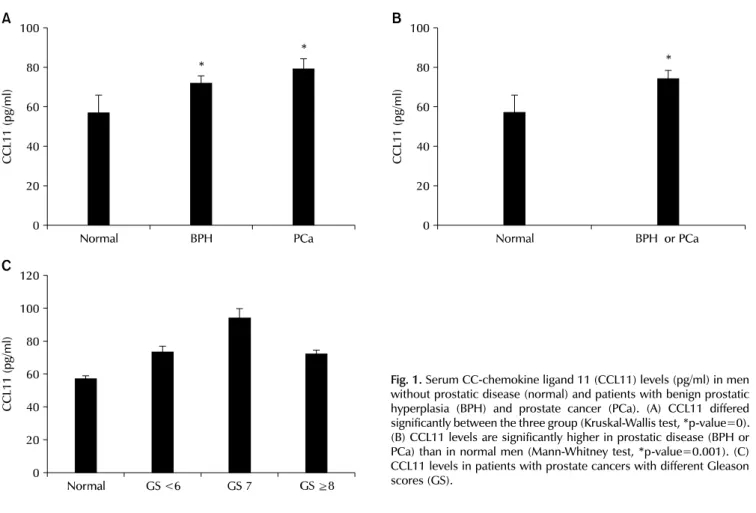 Fig. 1. Serum CC-chemokine ligand 11 (CCL11) levels (pg/ml) in men  without prostatic disease (normal) and patients with benign prostatic  hyperplasia (BPH) and prostate cancer (PCa)