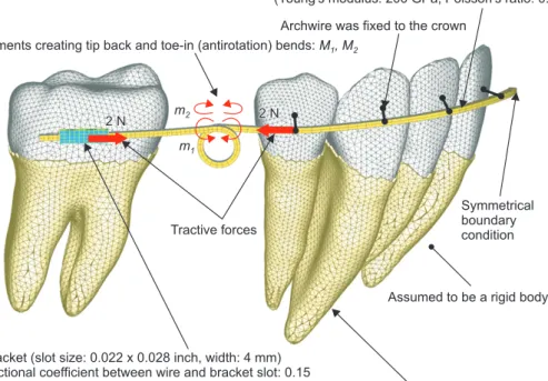 Figure 1. Finite element  model for simulating  ortho-dontic tooth movement.