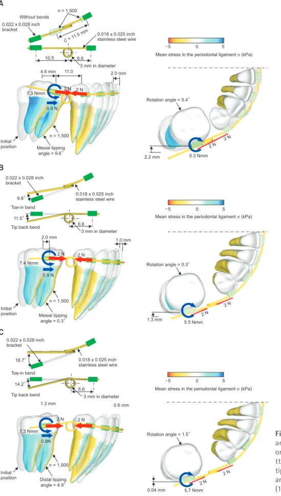 Figure 3. Effect of bending  angles of the running loop  on the tooth movement  pa-ttern