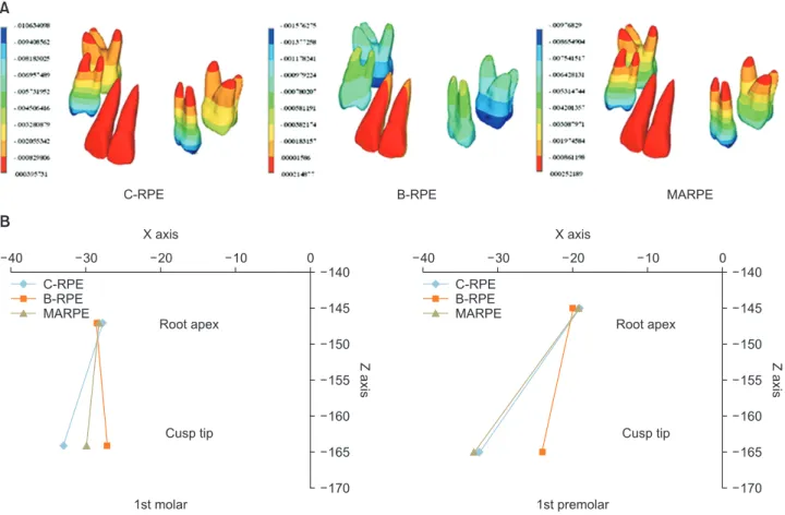 Table 4. Comparison of stresses (g/mm 2 ) and stress distribution patterns among different RPE appliances using finite ele- ele-ment analysis