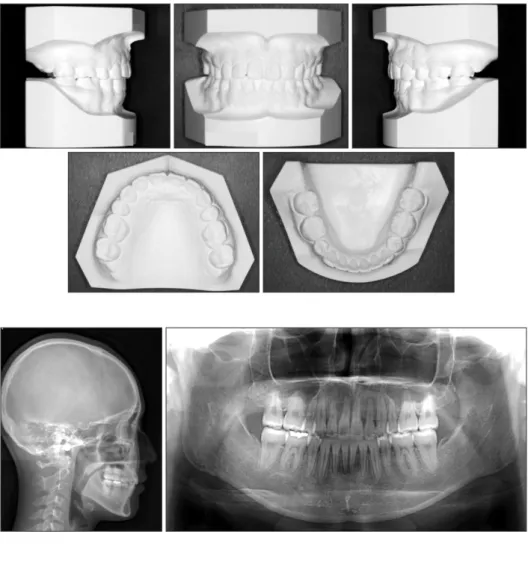 Figure 9. A post-treatment  lateral cephalogram and an  or-thopantomogram.