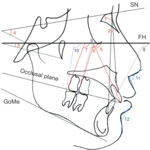 Figure 2. Angular cephalometric variables used for  analyzing the effects of four premolar extraction or the  modified C-palatal plate