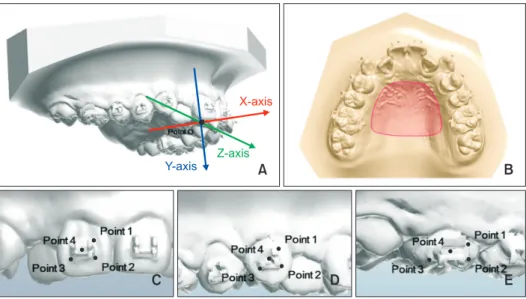 Figure 1. Three-dimensional (3D) digital model of the maxillary dentition. A, The 3D coordinate system for eva luating  tooth movement; B, reference area (red) for su perimposition; C, re ference points on the maxillary in cisor; D, maxillary  canine; and 