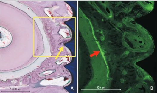 Figure 5 shows that the miniscrew threads that in- in-vaded the bundle bone did not exhibit contact with the  surrounding bone