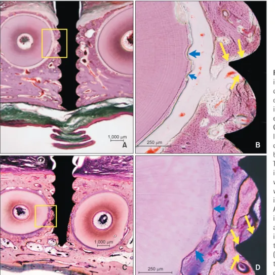 Figure 5. Effects of the prox- prox-imity of an orthodontic  minis-crew body to the bundle bone  on the surrounding bone