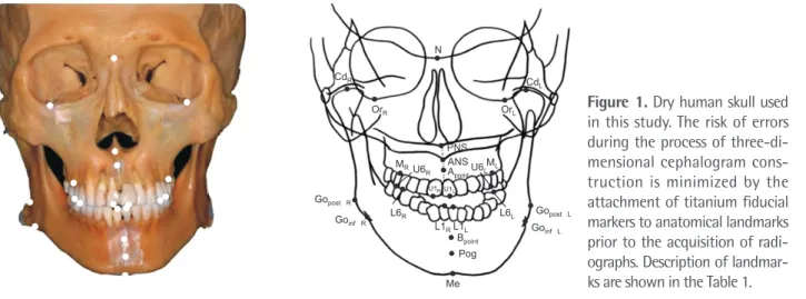 Figure 1. Dry human skull used  in this study. The risk of errors  during the process of  three-di-mensional cephalogram  cons-truction is minimized by the  attachment of titanium fiducial  markers to anatomical landmarks  prior to the acquisition of  radi