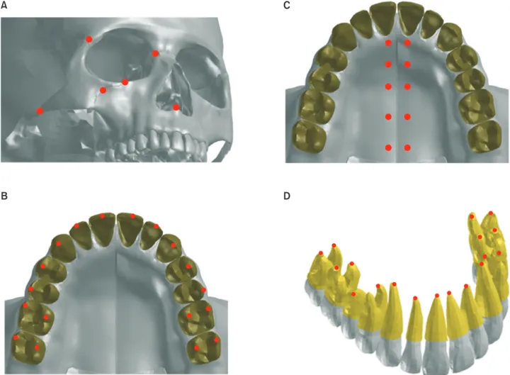 Figure 1. Illustrations of the skeletal and dental landmarks. A, Skeletal landmarks; B, Land marks at the midpalatal suture; C,  Occlusal dental landmarks; and D, Radicular dental land marks.
