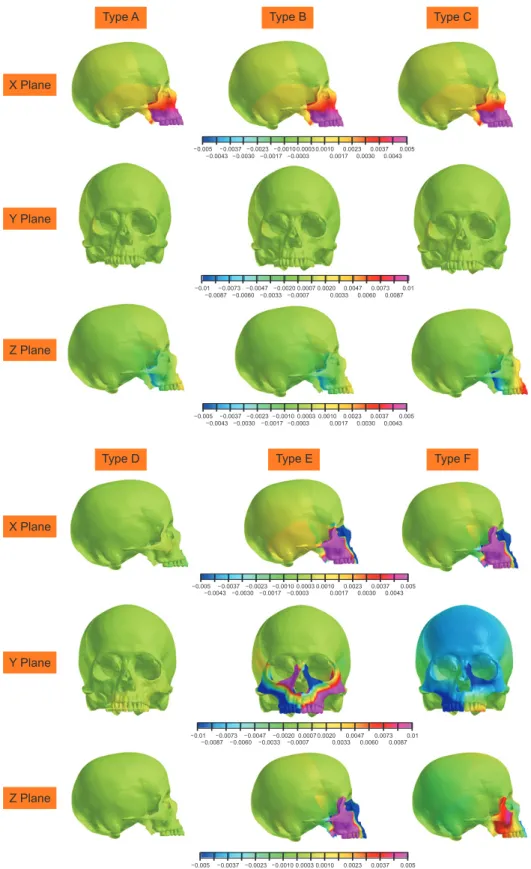 Figure 3. Displacement of the  skull and maxillary complex  along the X, Y, and Z axes.