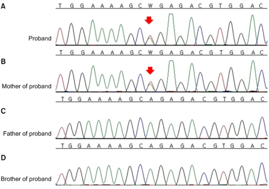 Fig. 3. Direct sequencing analysis  of FLCN. (A) The proband was  het-erozygous for a nonsense mutation,  c.1135A ＞T, p.Arg379*