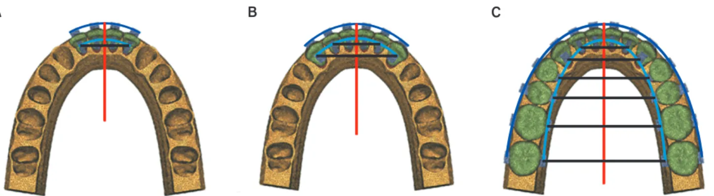 Figure 3. Schematic representation of the finite-element models of the three teeth groups
