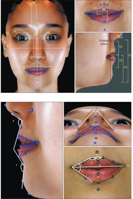Figure 2. Linear variables. 1,  Inter-endocanthal width; 2,  pupil width; 3,  inter-exocanthal width; 4, eye  width; 5, facial width; 6, nasal  width; 7, philtrum width; 8,  mouth width; 9, lower-facial  width; 10, total facial height; 