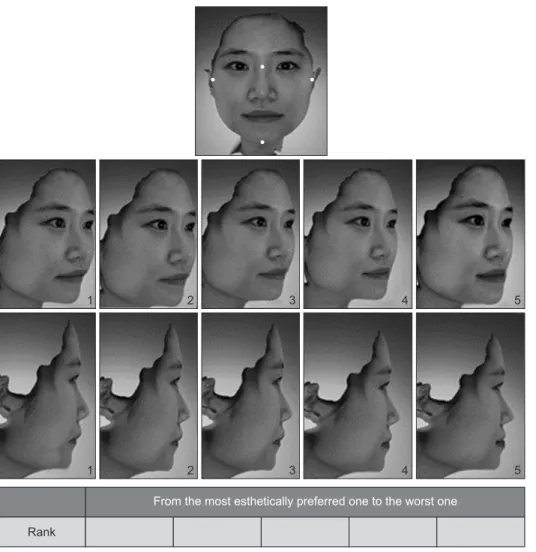 Figure 5. Three-dimensional  fa cial scan images of a wo man  with an euryprosopic fa cial  type and modification of the  chin projection as de scribed in  the legend of Figure 2.
