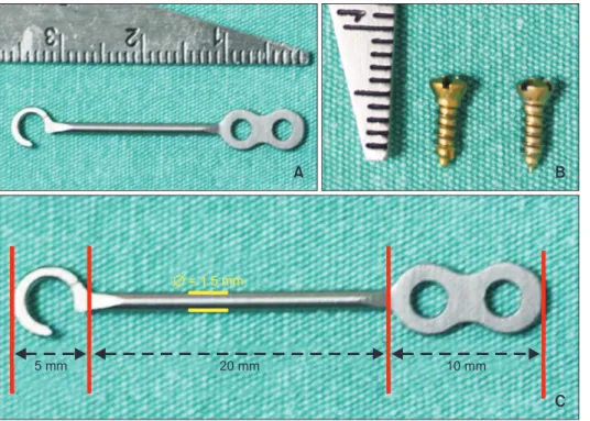 Figure 1. A and B, Miniplates  and screws used for fixation. 