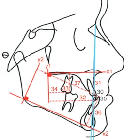 Figure 6. Cephalometric linear dental measurements  evaluated in the present study.