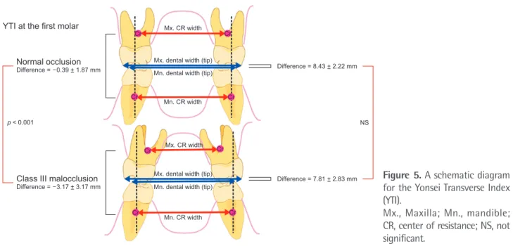 Figure 5. A schematic diagram  for the Yonsei Transverse Index  (YTI). 