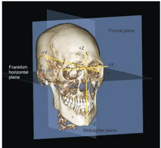 Figure 1. Landmarks and reference planes. 