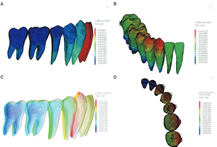 Figure 3. Teeth movements according to force application at the bracket level. A, Displacement of Y­axis