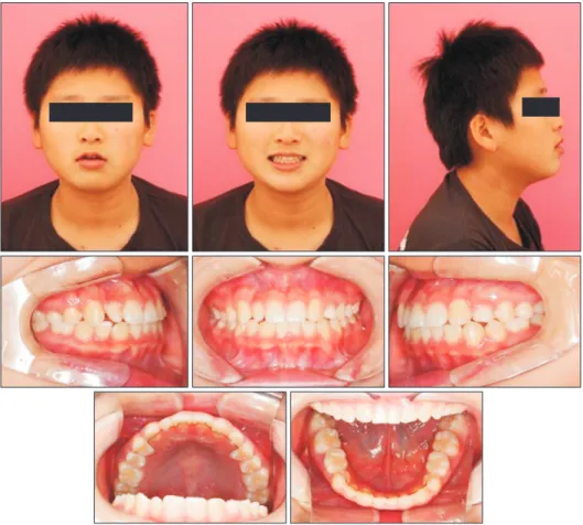 Figure 7. Post­treatment fa­