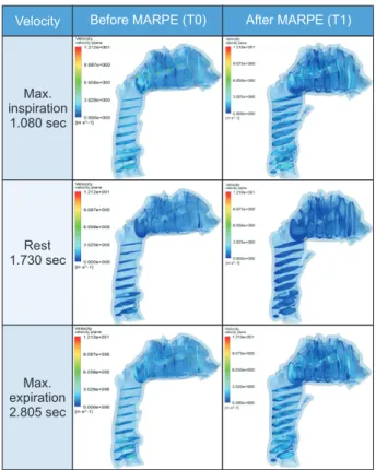 Figure 4. Changes in airflow velocity in the nasal cavity  and pharynx at maximum (Max.) inspiration, rest, and  Max