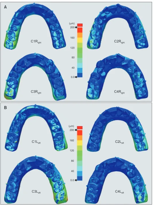 Figure 4. A color presentation  of the deviations between  surfaces from the Trios®  sca-nner