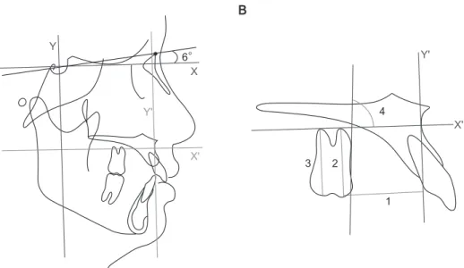 Figure 2. Cephalometric measurements. A, The X-Y coordinate was constructed using a horizontal rotating sella-nasion  line in a downward direction at 6° (X-axis) and a vertical line perpendicular to the horizontal line passing through  the sella point (Y-a