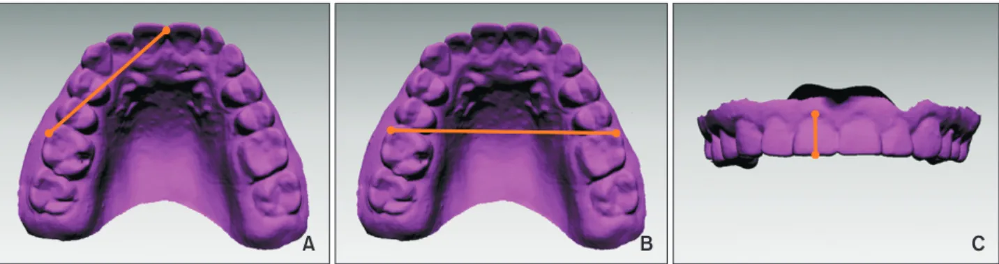 Figure 2. Linear measurements made on each digital model. A, Incisor to molar; B, intermolar width; C, incisor height.