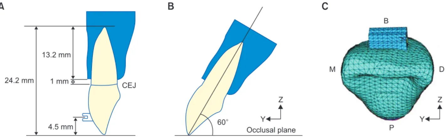 Figure 1. The basic model of an incisor. A, Tooth length, 24.2 mm; tooth root, 13.2 mm; bracket position midpoint, 4.5  mm