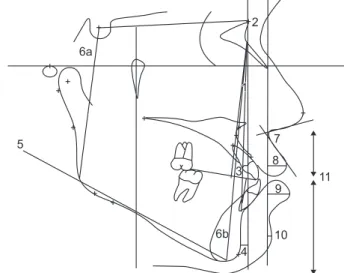 Figure 3. Cephalometric reference lines and variables. 