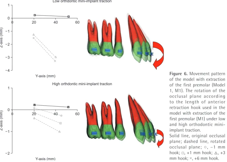 Figure 6. Movement pattern  of the model with extraction  of the first premolar (Model  1, M1)