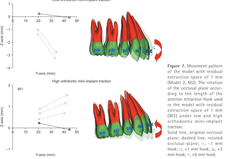 Figure 7. Movement pattern  of the model with residual  extraction space of 1 mm  (Model 2, M2)