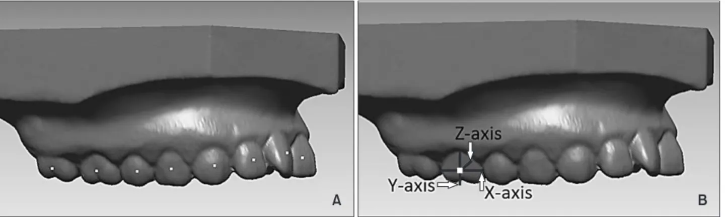 Figure 3. A, Facial axis (FA) points. B, Definition of the coordinate system established at the FA point; the X-axis is the  horizontal one, the Y-axis is the vertical one, and the Z-axis is a sagittal axis perpendicular to the X-axis and Y-axis.