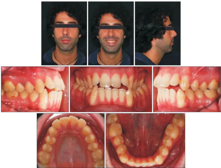 Figure 1. Pretreatment photographs. 