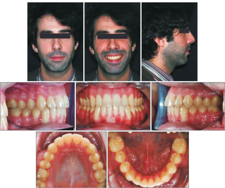 Figure 10. Post-treatment photographs.