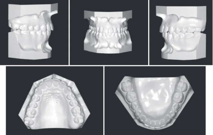 Figure 12. Post-treatment panoramic radiograph.