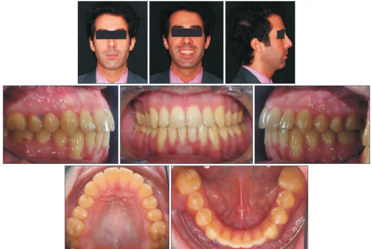 Figure 16. Appearance 3 years 5 months after the treatment.