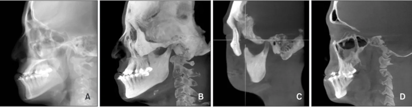 Figure 1. Generation of cone-beam computed tomography generated half-cephalograms. Raycast images